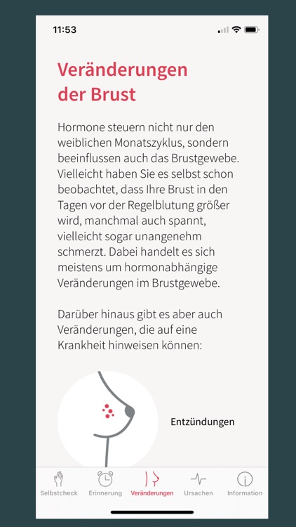 Selbstuntersuchung der Brust screenshot-3