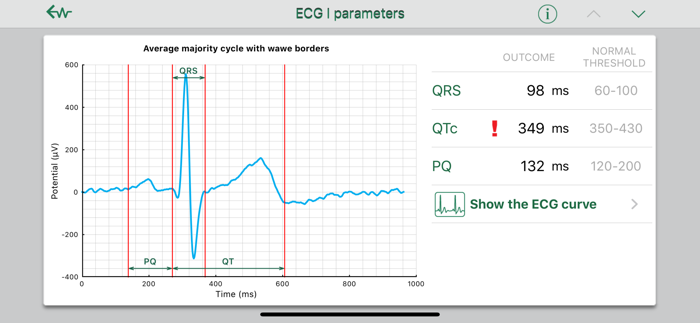 WIWE - ECG diagnostics