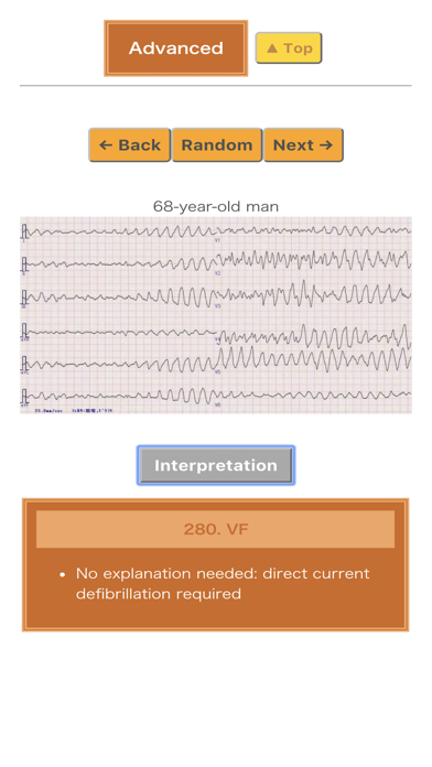 Pocket ECG screenshot 4