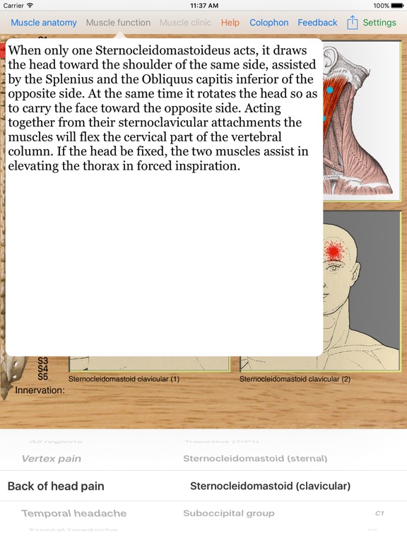 Dry Needling Proのおすすめ画像3