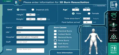 3D PED Burn Resuscitation