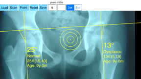 CenterEdgeAngleApp screenshot