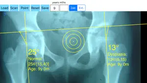 CenterEdgeAngleApp screenshot 2