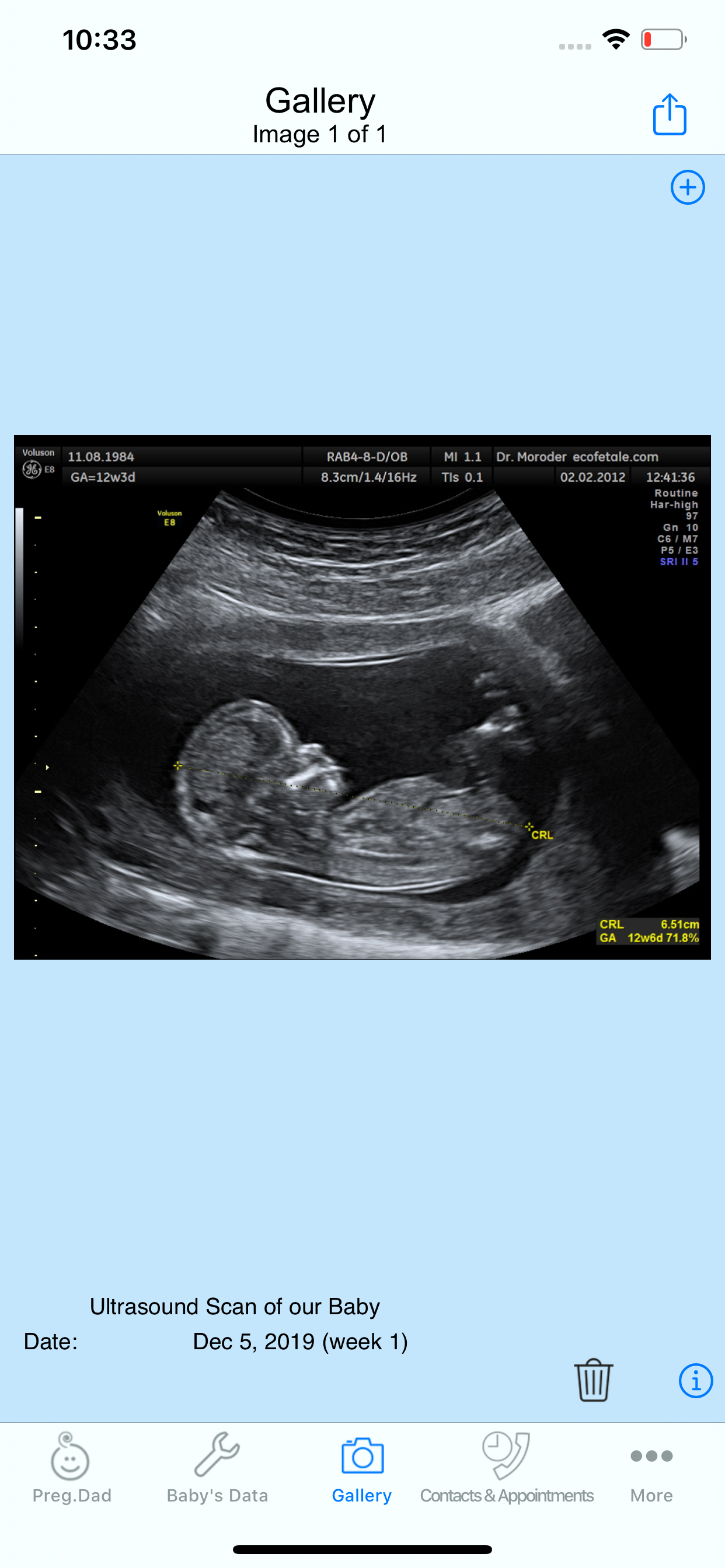 Pregnant Dad N*