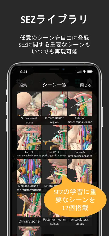 脳観