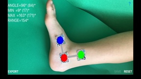 DynamicGoniometerAR screenshot