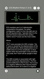 ecg rhythms and acls cases iphone screenshot 2