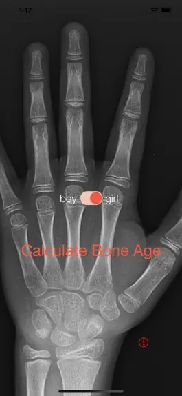 Game screenshot Bone Age mod apk