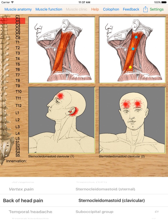 Screenshot #5 pour Dry Needling Pro