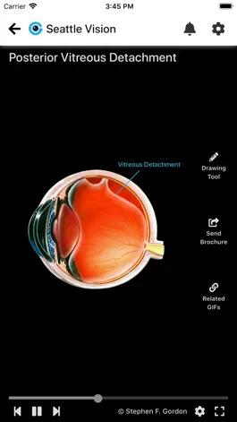 Game screenshot Eye GIFs - Patient Education apk