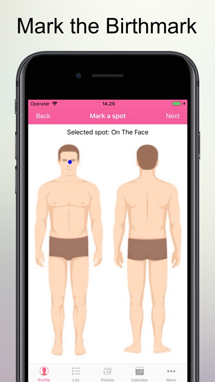 Skin Cancer Check screenshot-4