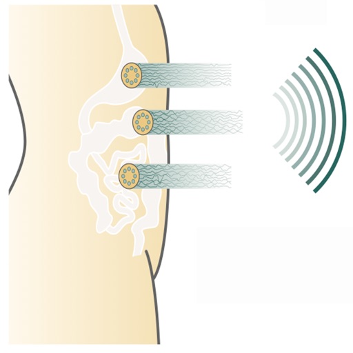 G-Tech Patch Monitor