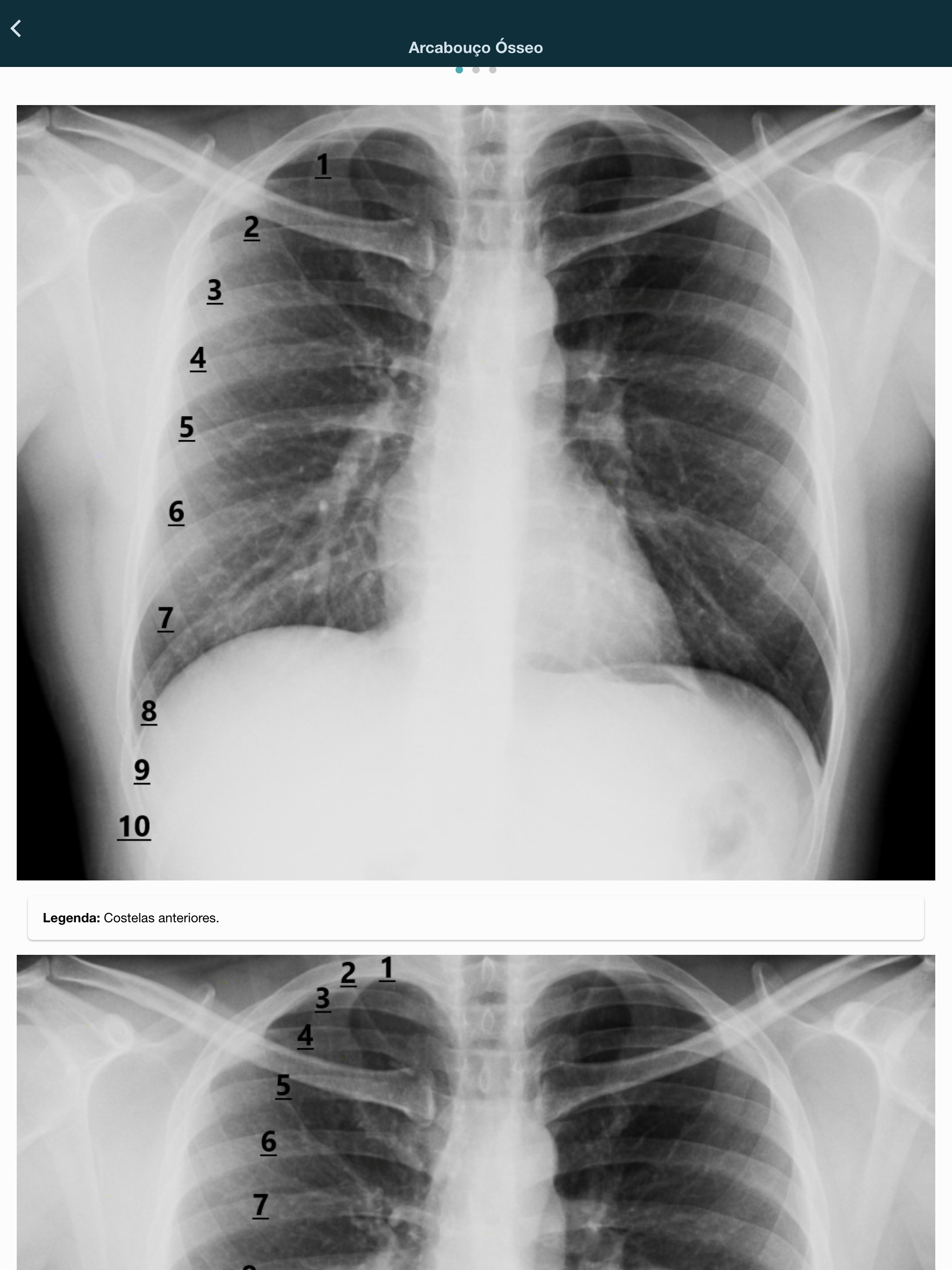 Thorax - thoracic radiology screenshot 13