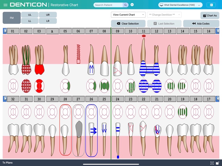 Denticon - Clinical screenshot-3