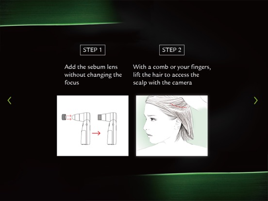 Screenshot #4 pour Scalp Analyzer