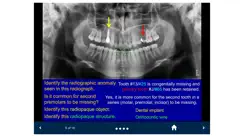Oral Radiology - SecondLook iPhone image 2