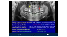 Game screenshot Oral Radiology - SecondLook apk