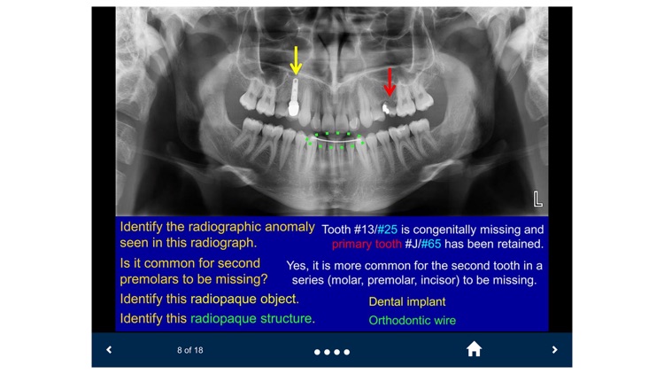 Oral Radiology - SecondLook