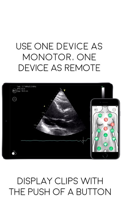 Awesome Ultrasound Simulatorのおすすめ画像1