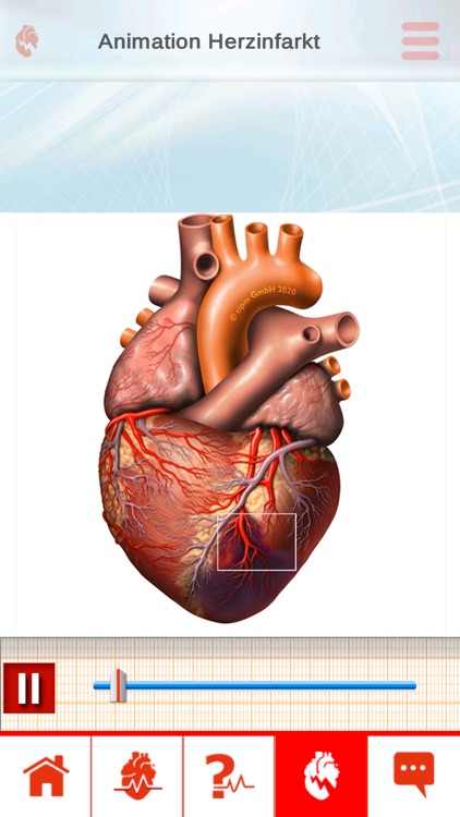 ECGinMotion screenshot-4