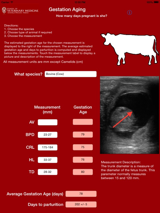 Gestation Aging