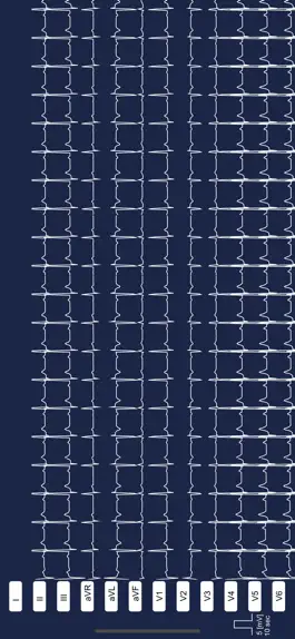 Game screenshot Multi-ECG hack