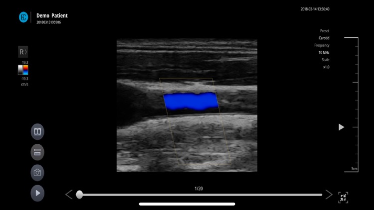 SONON X Ultrasound App