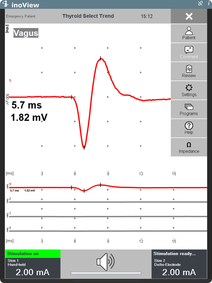 #5. inoView (iOS) 由: inomed Medizintechnik GmbH