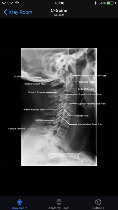 iRad Xrays screenshot1