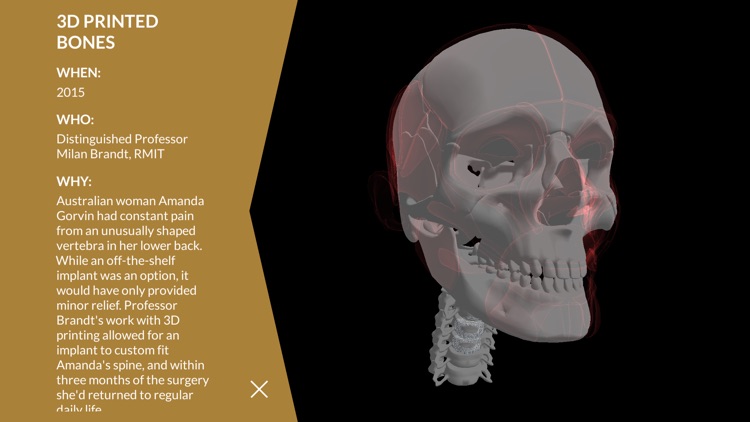 100 Years EA screenshot-5