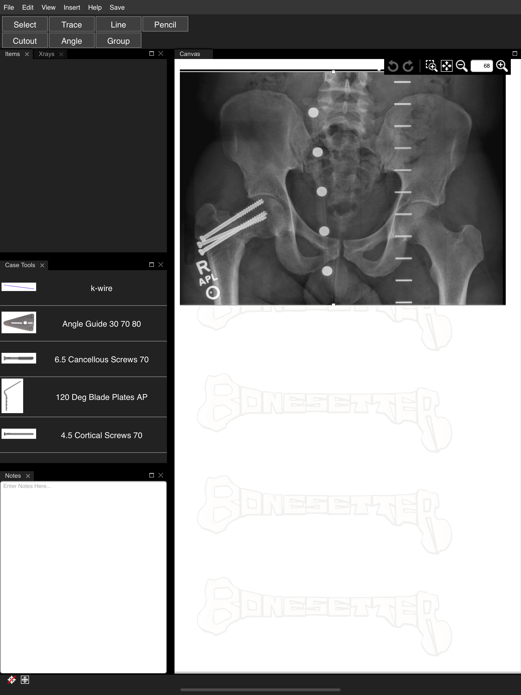 Bonesetter Learning screenshot 4