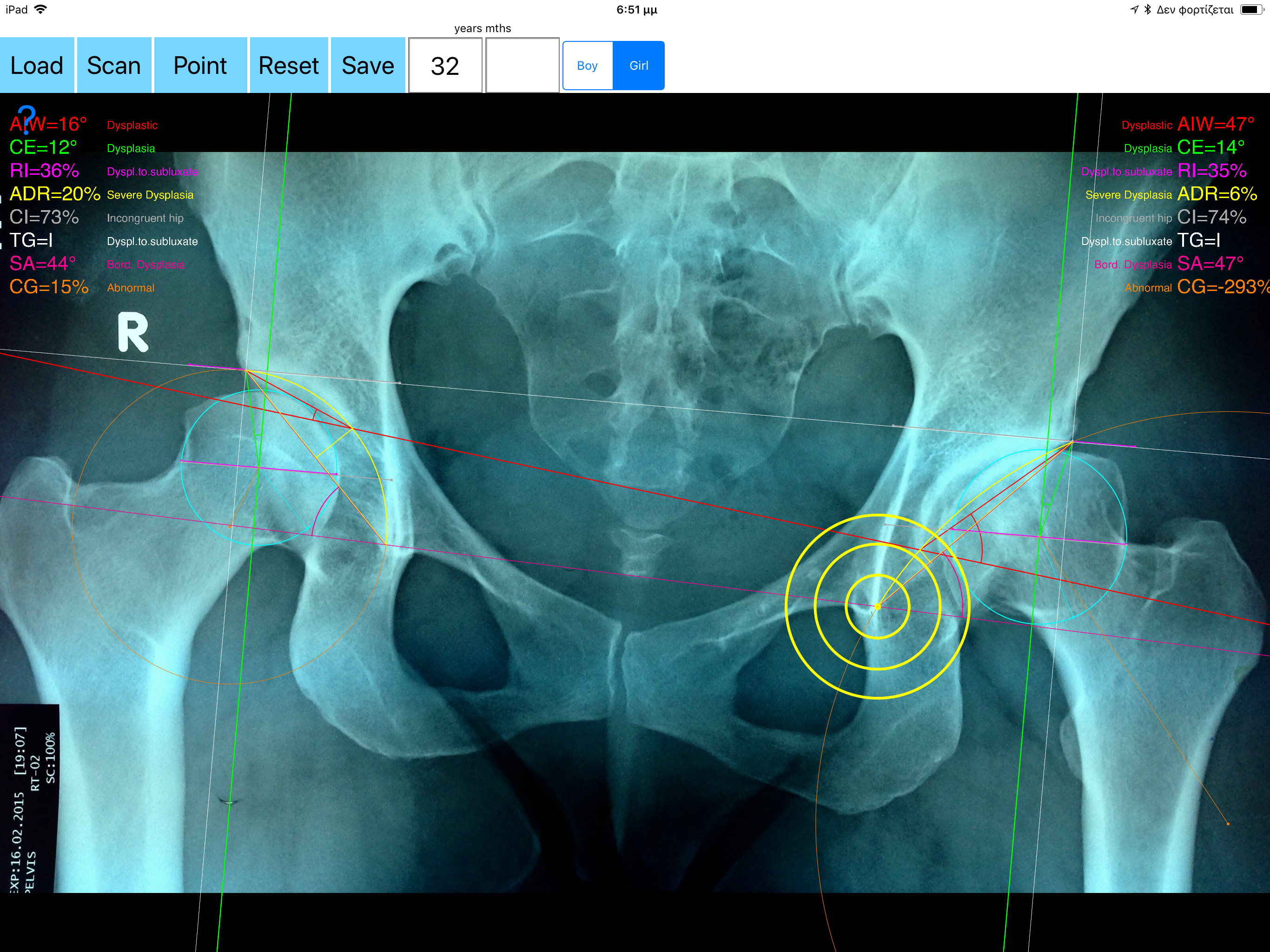 HipDysplasiaApp screenshot 14