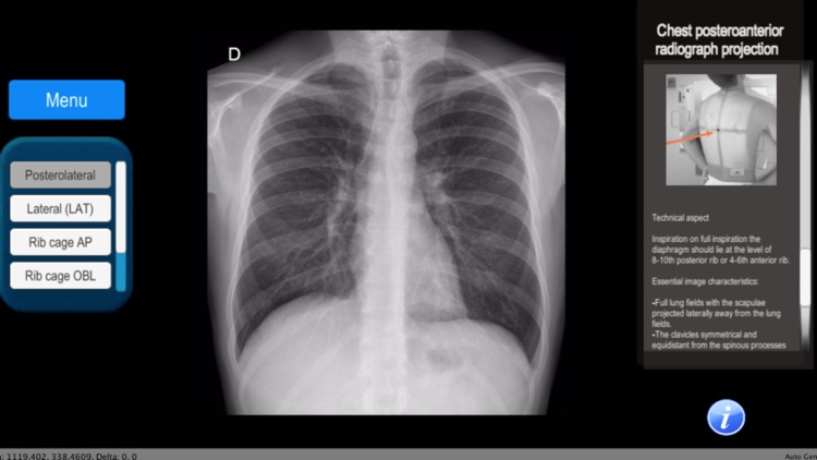 Anatomy and X-Ray Positioning