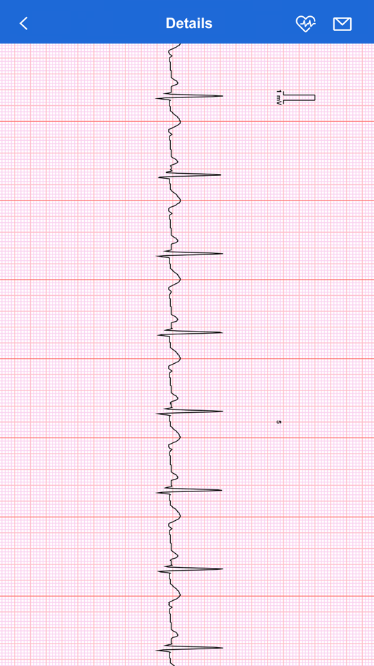 #4. iBP ECG Plus (iOS) 来自: MD Biomedical, Inc.