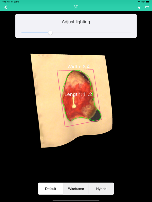 Parable iPad screenshot 8 - Medical app
