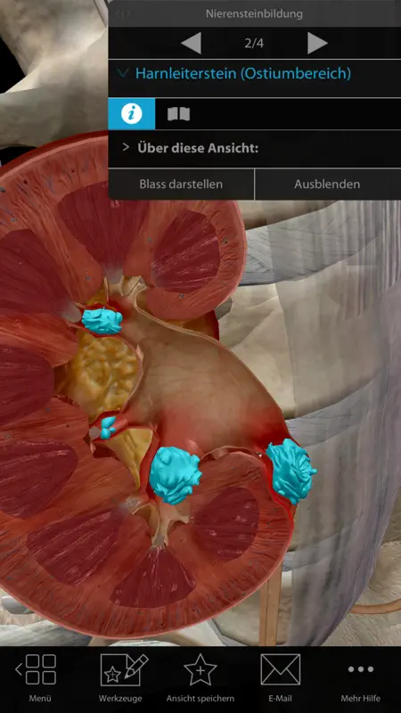Physiologie & Pathologie screenshot 4 of 10