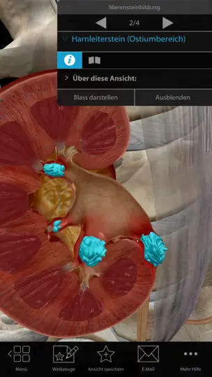 Screenshot von Physiologie & Pathologie auf dem iPhone 4
