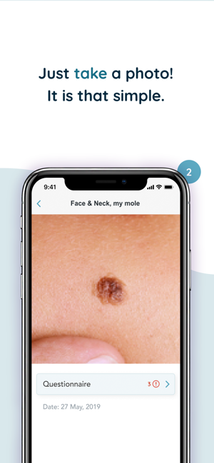‎MoleCare Screenshot