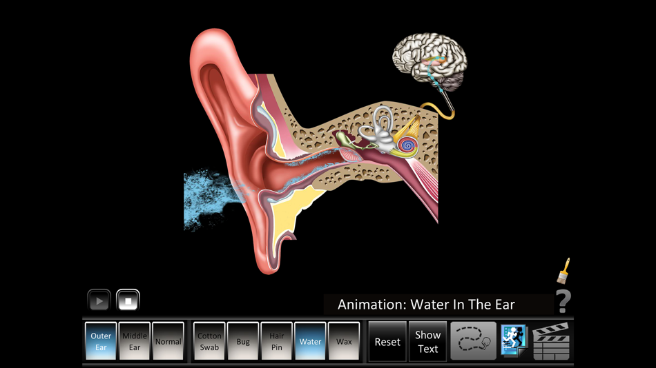 #3. Ear Disorders: Outer Middle (iOS) 由: Blue Tree Publishing, Inc.
