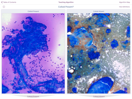 Thyroid Pathology iPad screenshot