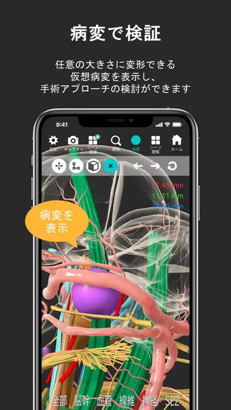 脳観