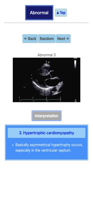 Pocket Heart Echo(圖3)-速報App