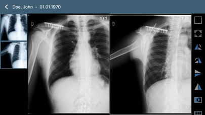 Screenshot #3 pour Issa PACS Client