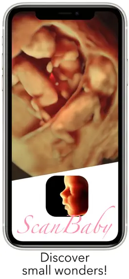 Game screenshot ScanBaby learn baby ultrasound mod apk