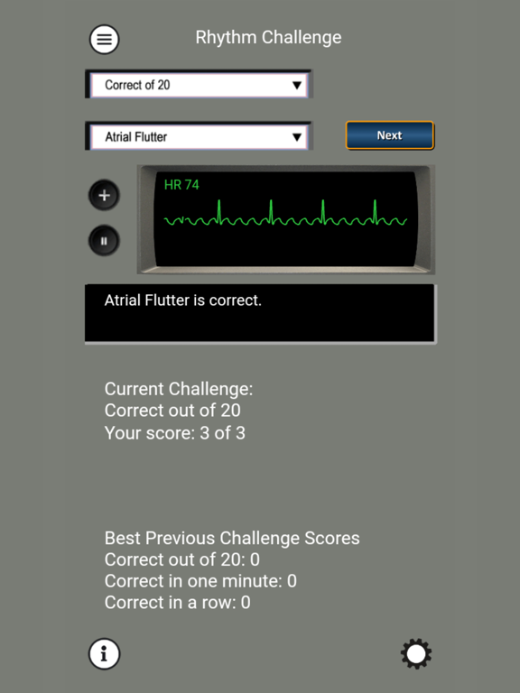 ECG Rhythms and ACLS Casesのおすすめ画像4