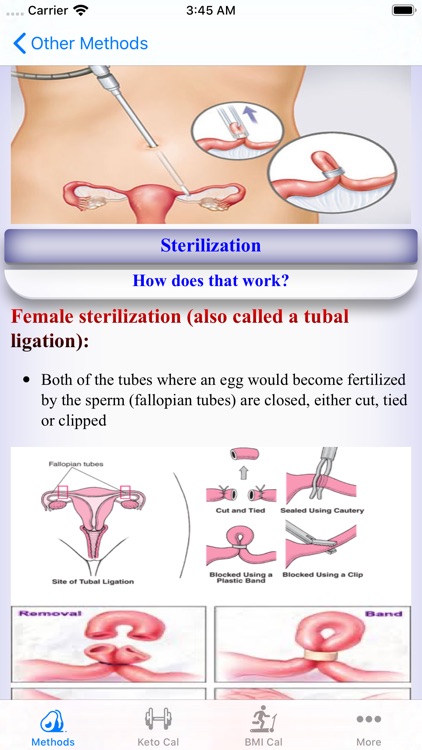 Methods of Contraception