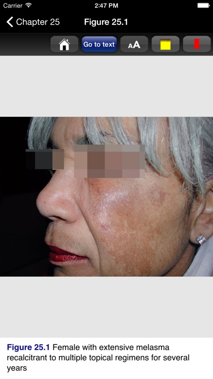 Color Atlas Cosmetic Derm, 2/E