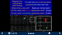 Fetal Heart Rate - SecondLook iPhone image 2