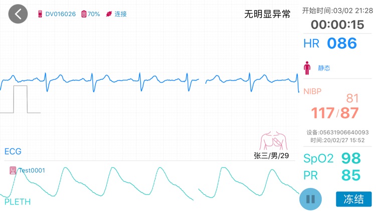 贴心-引领居家心脏监测潮流