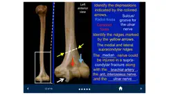 MSK Anatomy - SecondLook iPhone image 2
